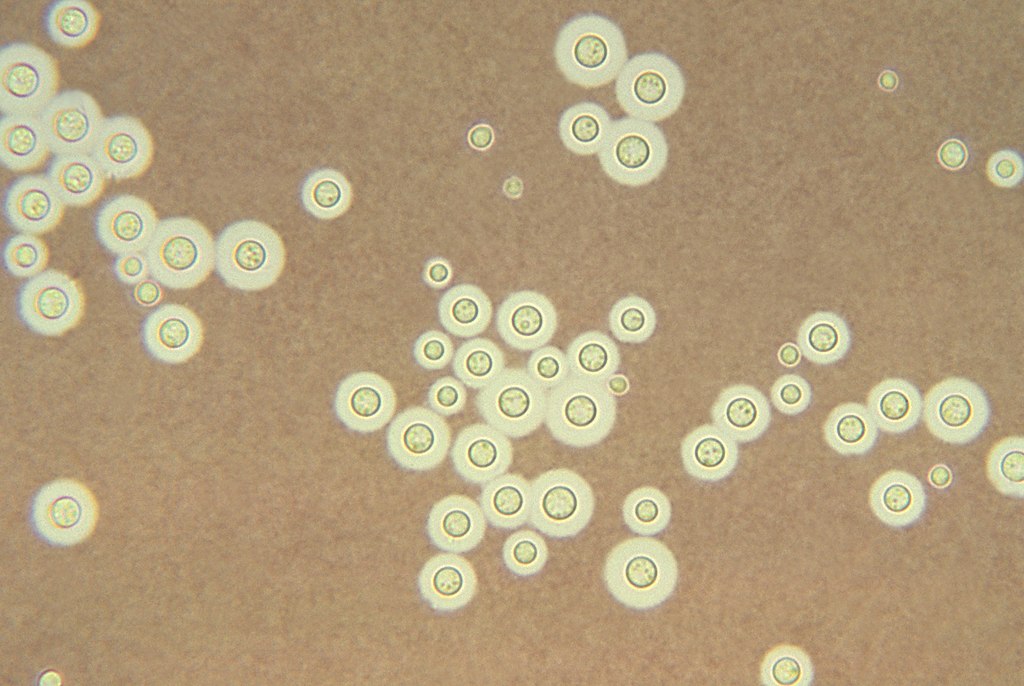 https://en.wikipedia.org/wiki/Radiotrophic_fungus#/media/File:Cryptococcus_neoformans_using_a_light_India_ink_staining_preparation_PHIL_3771_lores.jpg
